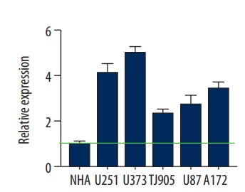 Expression of circ-CFH in different glioma cell lines.jpg